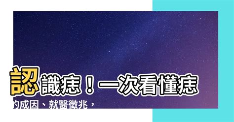 身體多痣|痣是什麼？一次了解痣原因、就醫時機以及如何改善